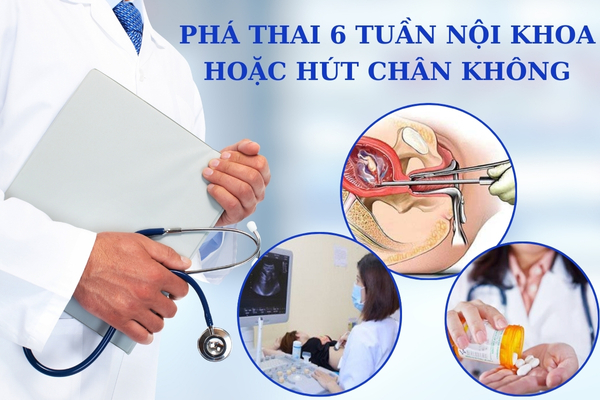 Phương pháp phá thai 6 tuần an toàn